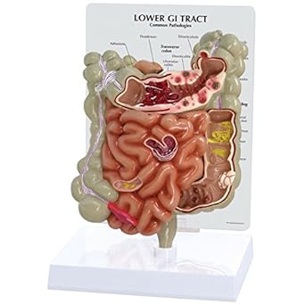 GPI Anatomicals 3342 Model de tract gastrointestinal, 1019556